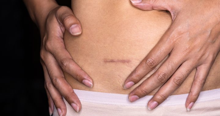 Rehabilitacja blizn szkolenie Warszawa jako istotny zakres nowoczesnej działalności z pacjentem